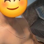 Rod Novo